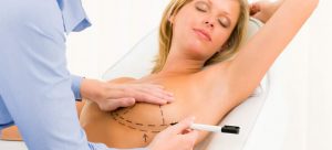 breast-surgery